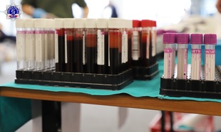 Na stole stoją pojemniki wypełnione próbkami krwi